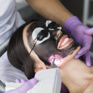Hollywood Peeling Carbon Laser mit pico Laser