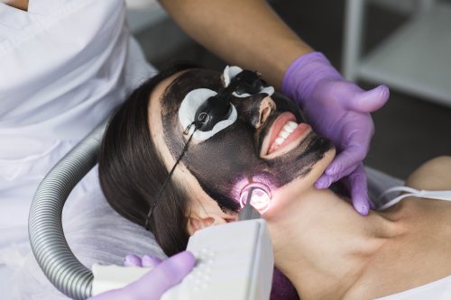 Hollywood Peeling Carbon Laser mit pico Laser