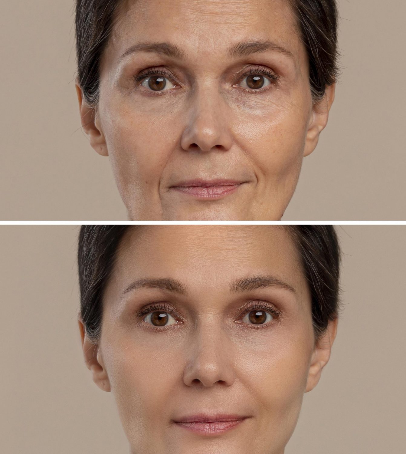 8 Punkt Facelift in Stuttgart