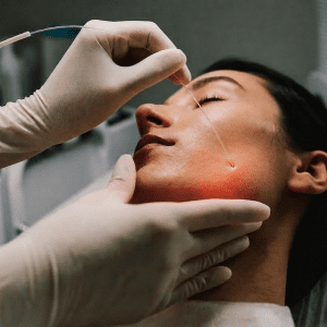 Endolift Endolaser Laserlift Endolipolyse Laserlipolyse Laserfaser Minimalinvasiv