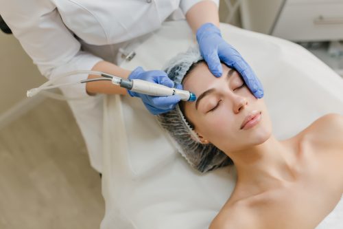 Medical-Needling für Hautverjüngung, Anregung der natürlichen Kollagenproduktion- Verbessert die Hautstruktur & mildert feine Linien & Narben